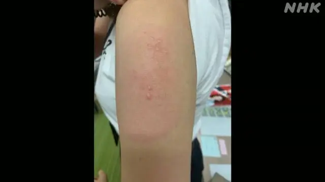 K10013240081_2109022019_2109022037_01_02.webp