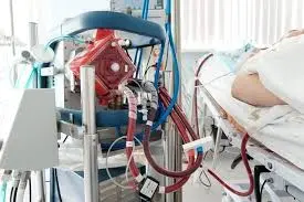 Thumbnail của bài viết: Nhật Bản: ECMO - phương án cuối cùng của điều trị viêm phổi corona mới. Không thể cứu sống bệnh nhân do thiếu nhân lực chuyên môn