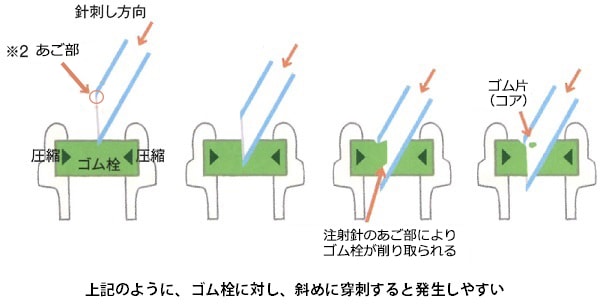201664_Mechanism_of_coring_occurrence_compression.jpg