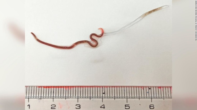 parasite.jpg