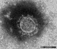 Ghi nhận chủng đột biến virus Corona mới "XBB.1.16", WHO thắt chặt giám sát.