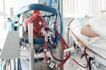 Nhật Bản: ECMO - phương án cuối cùng của điều trị viêm phổi corona mới. Không thể cứu sống bệnh nhân do thiếu nhân lực chuyên môn