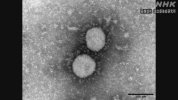 Chủng đột biến Delta : có nhiều khả năng gây ra các triệu chứng hơn các virus cho đến nay